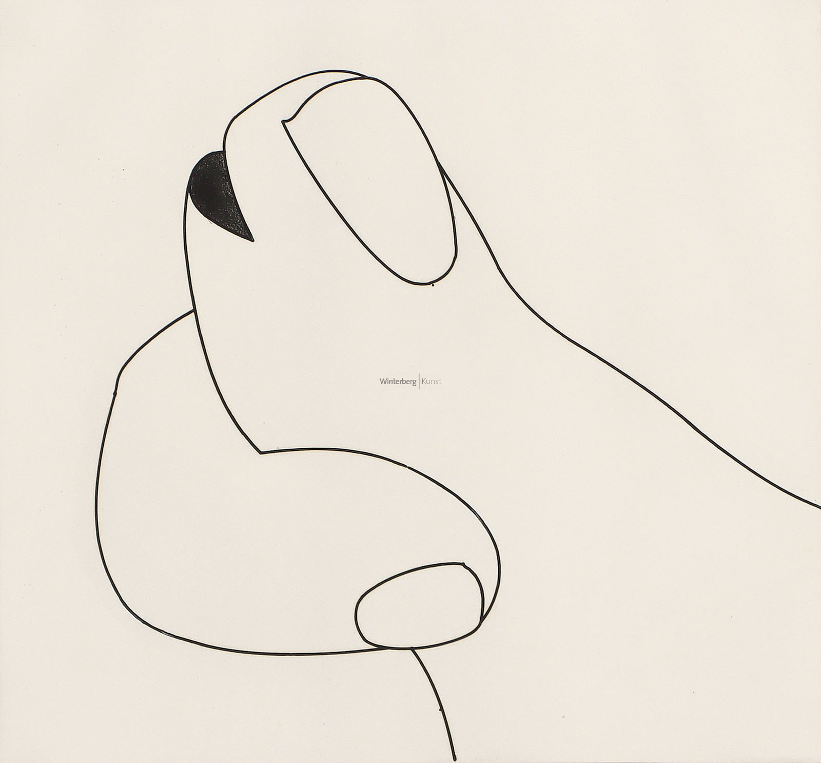 Verletzter Daumen mit Zeigefinger.